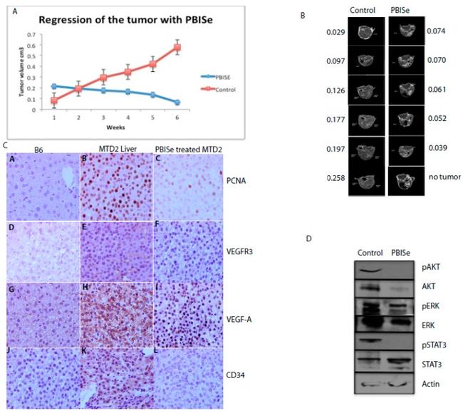 VEGF Receptor 3 Antibody in Immunohistochemistry, Immunohistochemistry (Paraffin) (IHC, IHC (P))