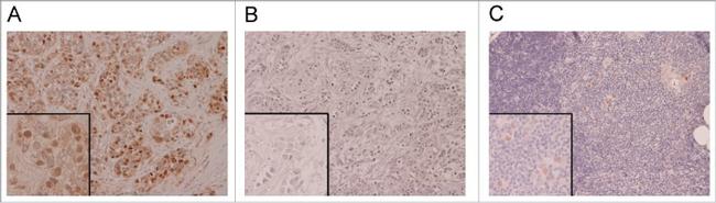 AIRE Antibody in Immunohistochemistry, Immunohistochemistry (PFA fixed) (IHC, IHC (PFA))