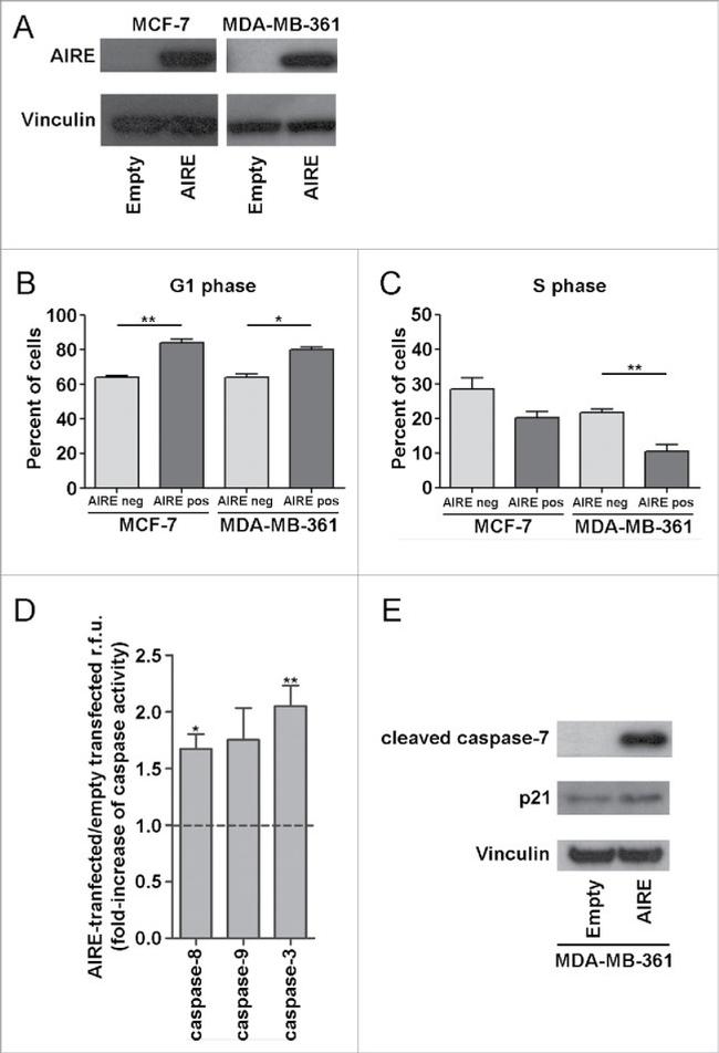 AIRE Antibody in Western Blot (WB)