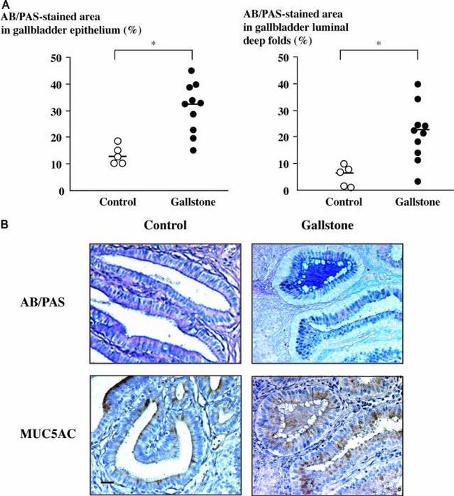 MUC5AC Antibody in Immunohistochemistry (IHC)