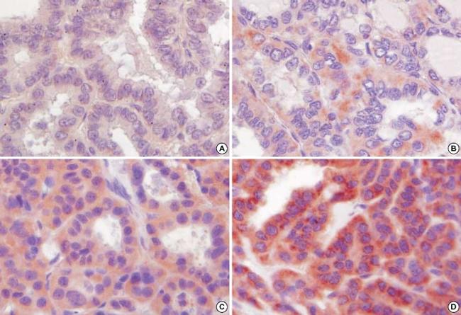 iNOS Antibody in Immunohistochemistry (IHC)