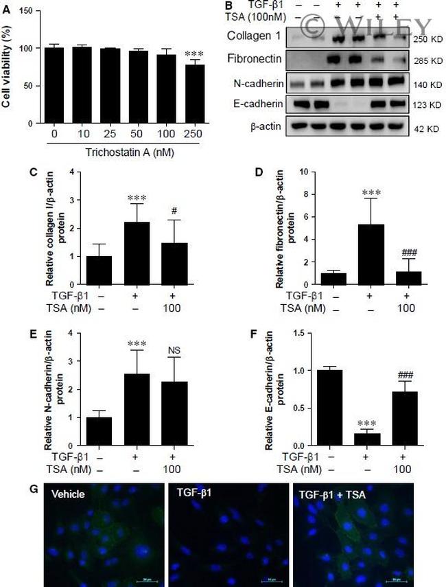 Fibronectin Antibody in Western Blot (WB)