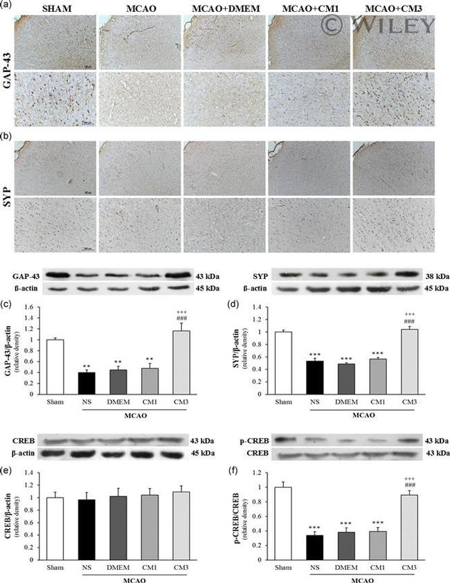 Synaptophysin Antibody in Western Blot, Immunohistochemistry (WB, IHC)