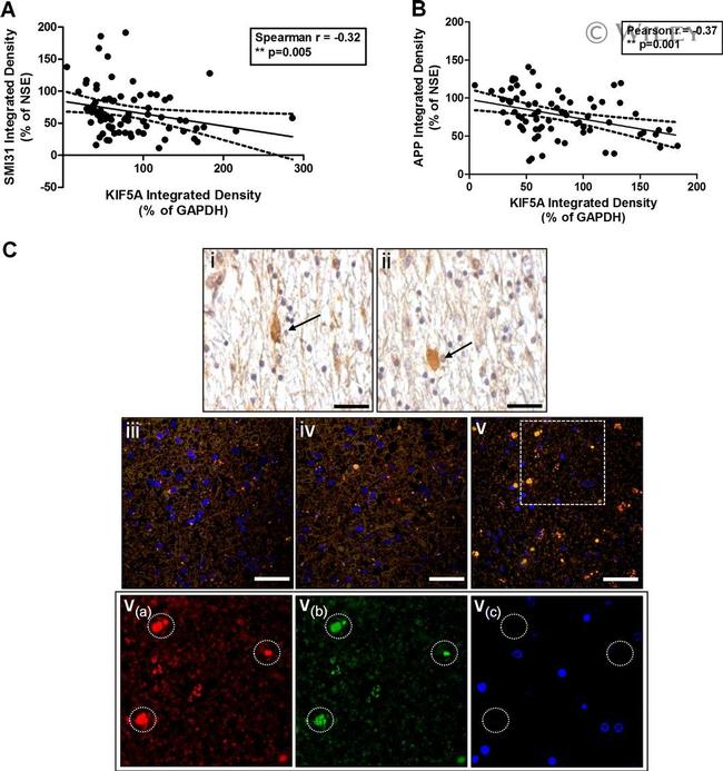 Amyloid Precursor Protein Antibody in Immunohistochemistry (IHC)