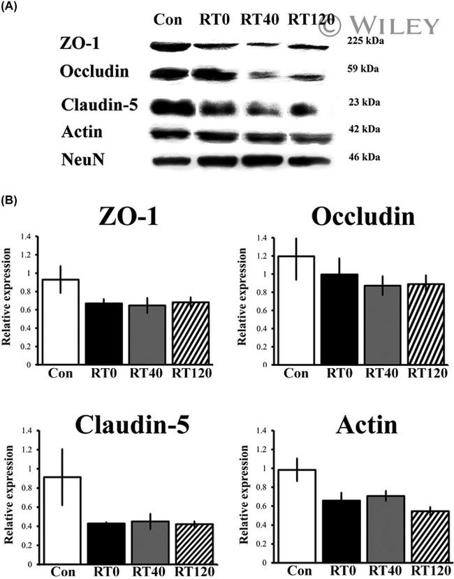 Occludin Antibody in Western Blot (WB)