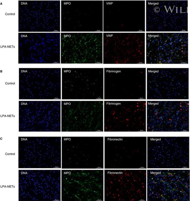 Fibronectin Antibody in Immunocytochemistry (ICC/IF)