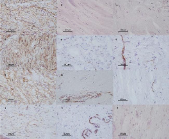 Connexin 26 Antibody in Immunohistochemistry (IHC)