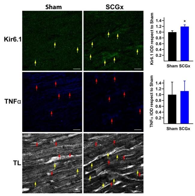 Kir6.1 (KCNJ8) Antibody in Immunohistochemistry (IHC)