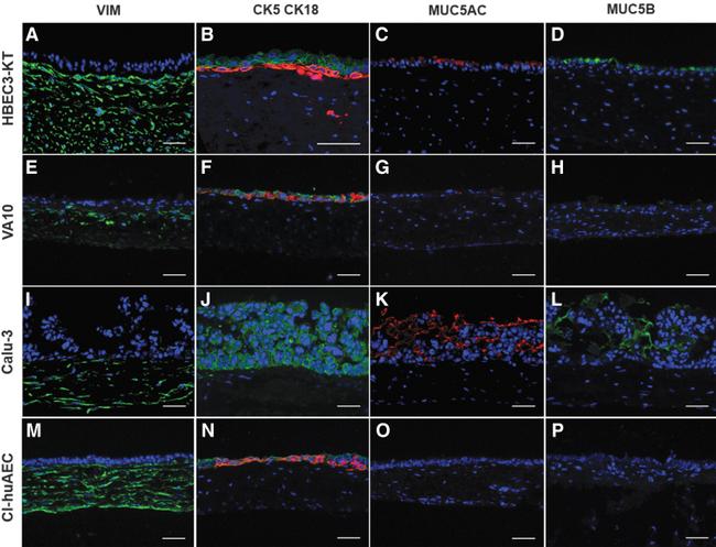 MUC5AC Antibody in Immunocytochemistry, Immunohistochemistry (ICC/IF, IHC)