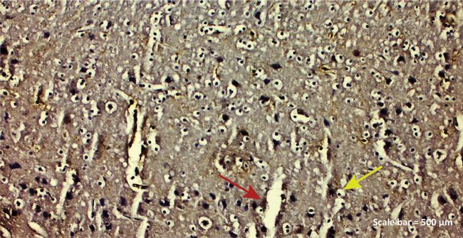 IBA1 Antibody in Immunohistochemistry (IHC)