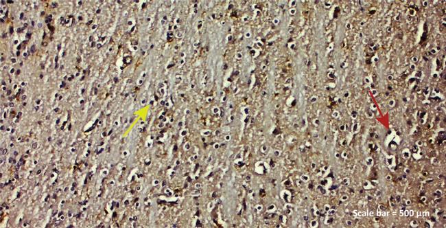 IBA1 Antibody in Immunohistochemistry (IHC)