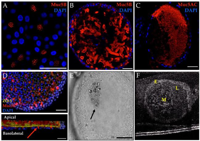 MUC5AC Antibody in Immunocytochemistry (ICC/IF)