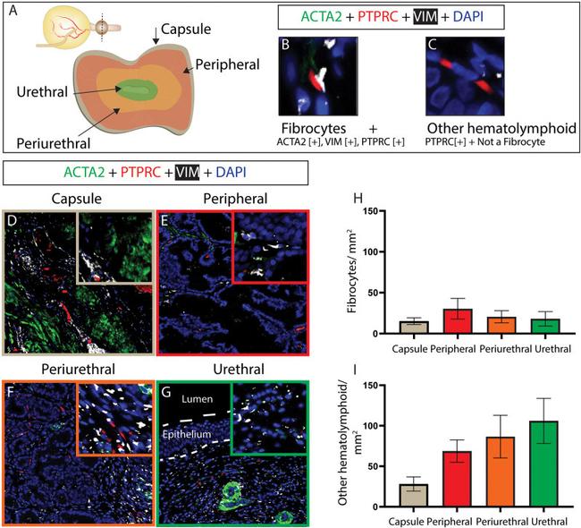 Alpha-Smooth Muscle Actin Antibody in Immunohistochemistry (IHC)