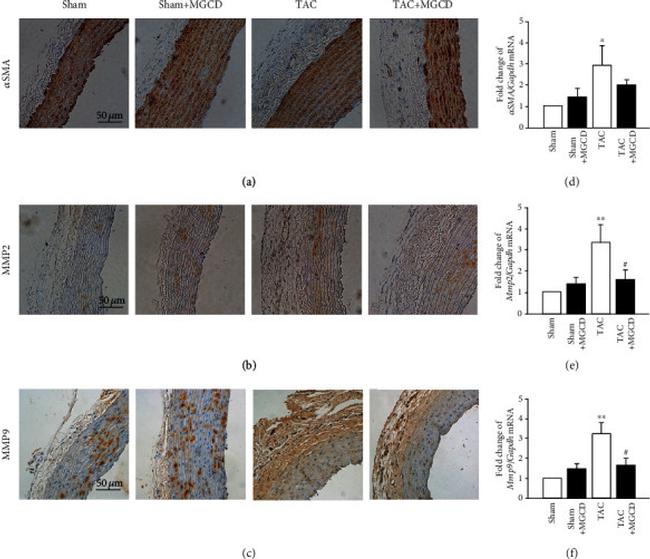 Alpha-Smooth Muscle Actin Antibody in Immunohistochemistry (IHC)