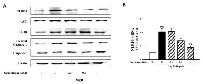 NLRP3 Antibody in Western Blot (WB)