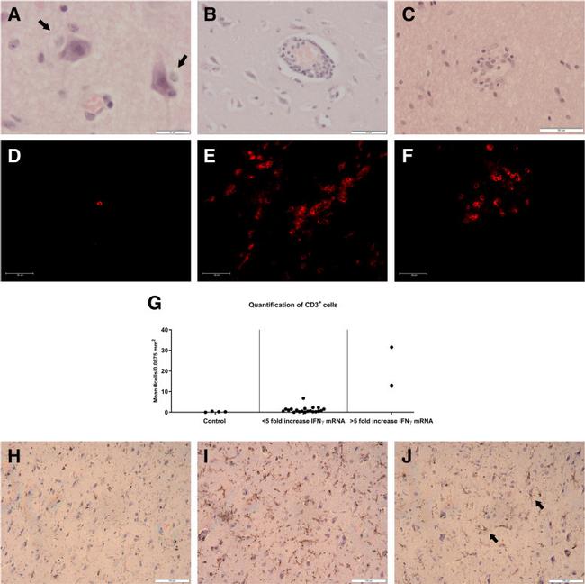 IBA1 Antibody in Immunohistochemistry (IHC)