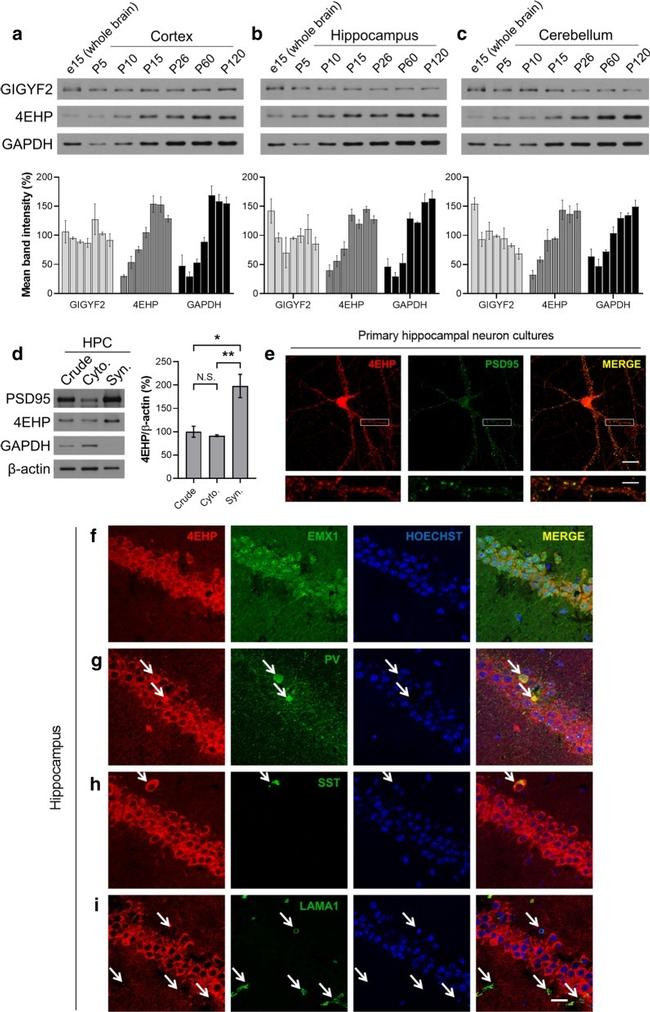 EMX1 Antibody in Immunohistochemistry (IHC)