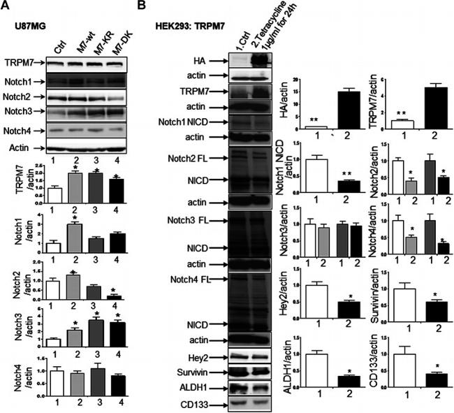 HEY2 Antibody in Western Blot (WB)