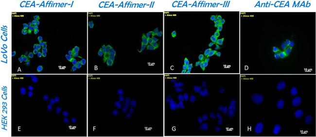CEA Antibody in Immunocytochemistry (ICC/IF)