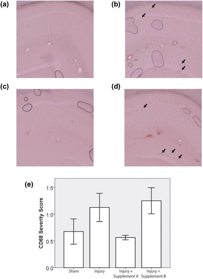 CD68 Antibody in Immunohistochemistry (IHC)