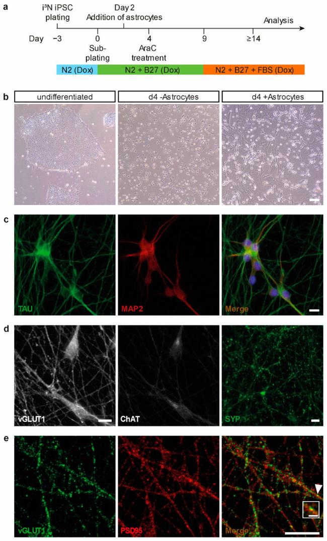 ChAT Antibody in Immunocytochemistry (ICC/IF)