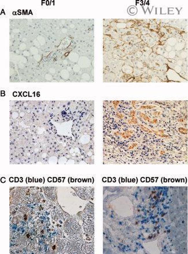 CD3 Antibody in Immunohistochemistry (IHC)