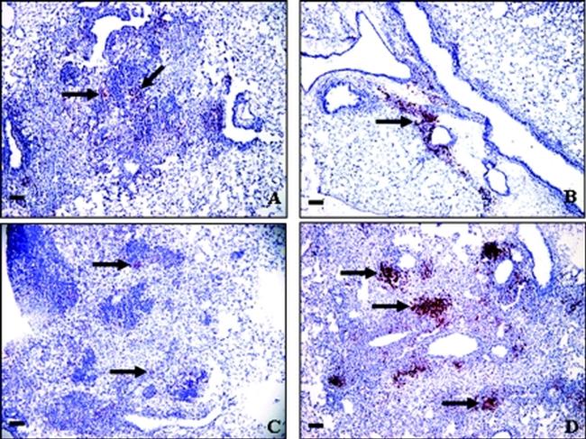 CD8a Antibody in Immunohistochemistry (IHC)