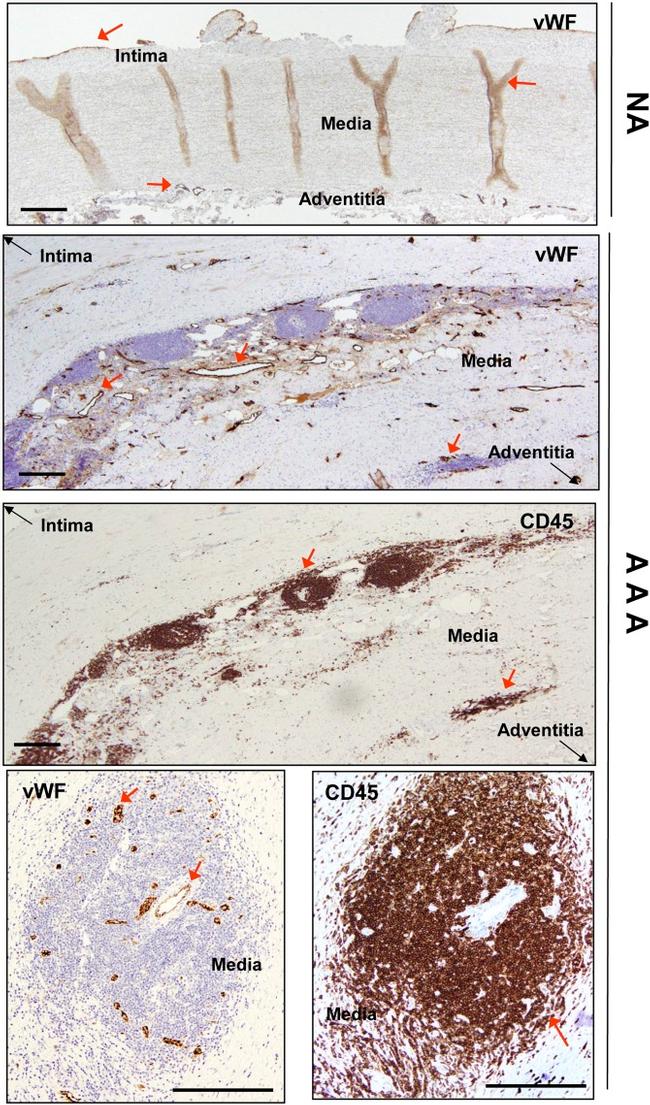 CD11b Antibody in Immunohistochemistry (IHC)