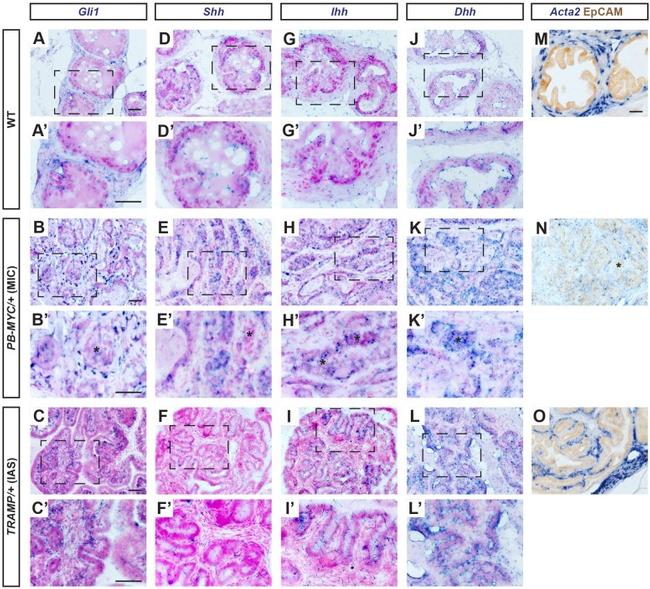 CD326 (EpCAM) Antibody in Immunohistochemistry (IHC)