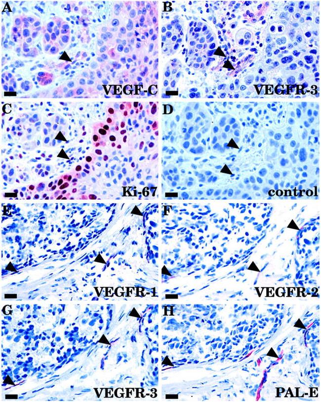 VEGF Receptor 3 Antibody in Immunohistochemistry (IHC)