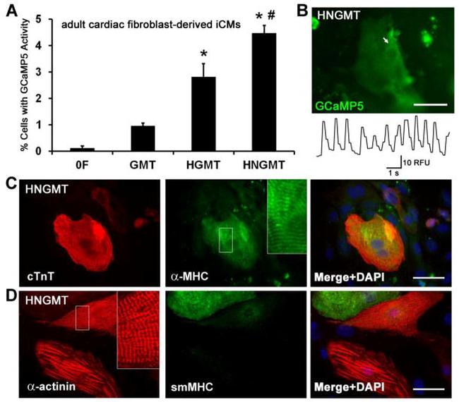 Myosin 4 Antibody in Immunocytochemistry (ICC/IF)