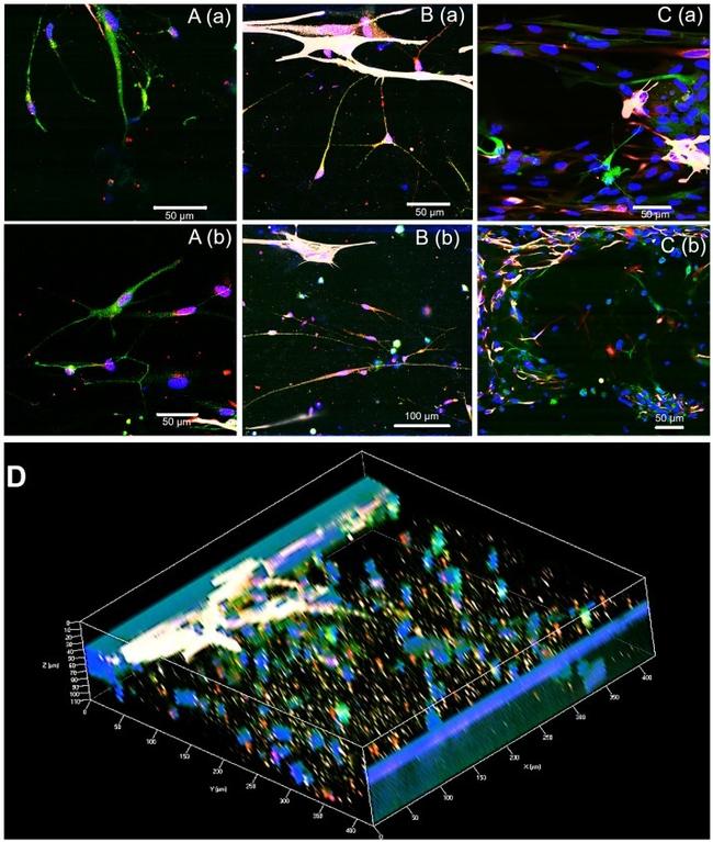 Synaptophysin Antibody in Immunocytochemistry (ICC/IF)