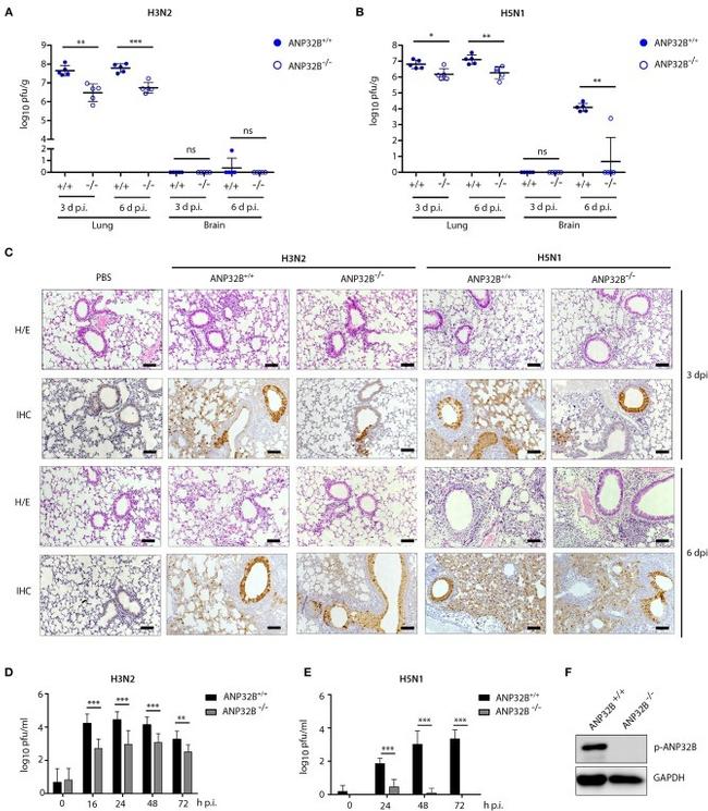 Influenza A NP Antibody in Immunohistochemistry (IHC)