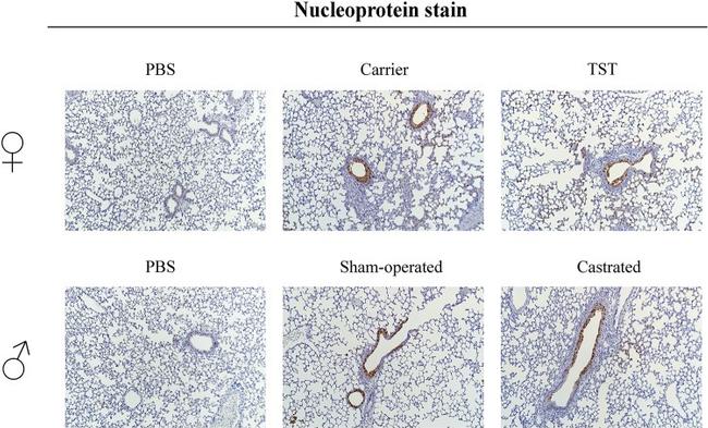 Influenza A NP Antibody in Immunohistochemistry (IHC)