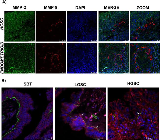 MMP2 Antibody in Immunohistochemistry (IHC)