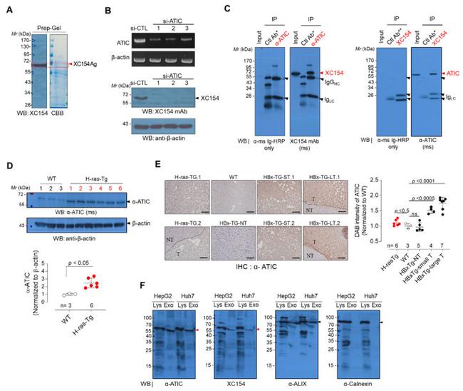 ATIC Antibody in Western Blot, Immunohistochemistry (Paraffin), Immunoprecipitation (WB, IHC (P), IP)