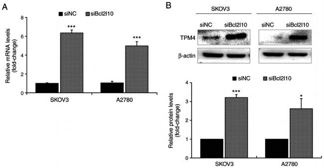 beta Actin Antibody in Western Blot (WB)