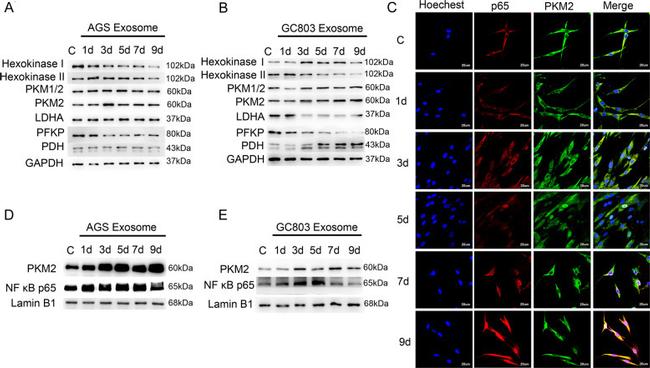 Nfkb P65 Monoclonal Antibody 572 436700 1862