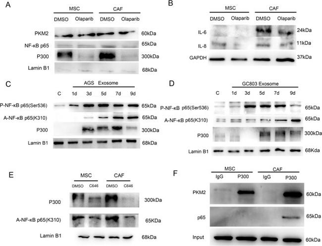 NFkB p65 Antibody in Western Blot (WB)