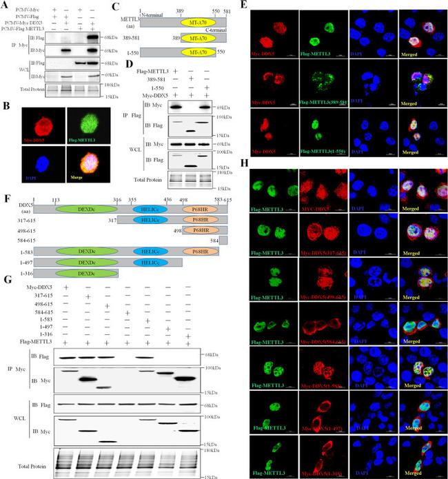 METTL3 Antibody in Immunoprecipitation (IP)