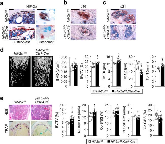 p21 Antibody in Immunohistochemistry (IHC)