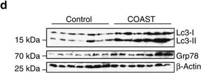 Rat IgG (H+L) Secondary Antibody in Western Blot (WB)