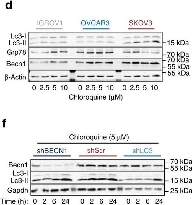 Rat IgG (H+L) Secondary Antibody in Western Blot (WB)