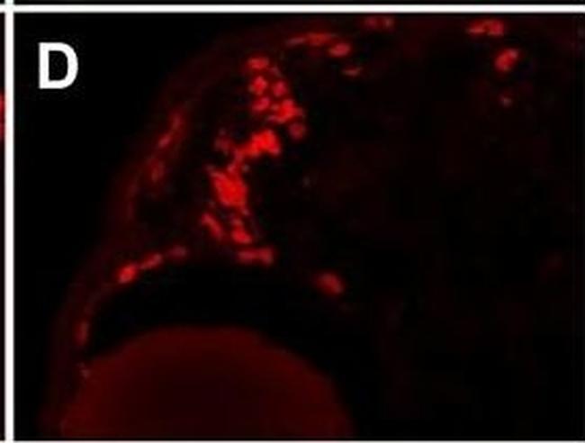 Mouse IgG2a Cross-Adsorbed Secondary Antibody in Immunohistochemistry (IHC)