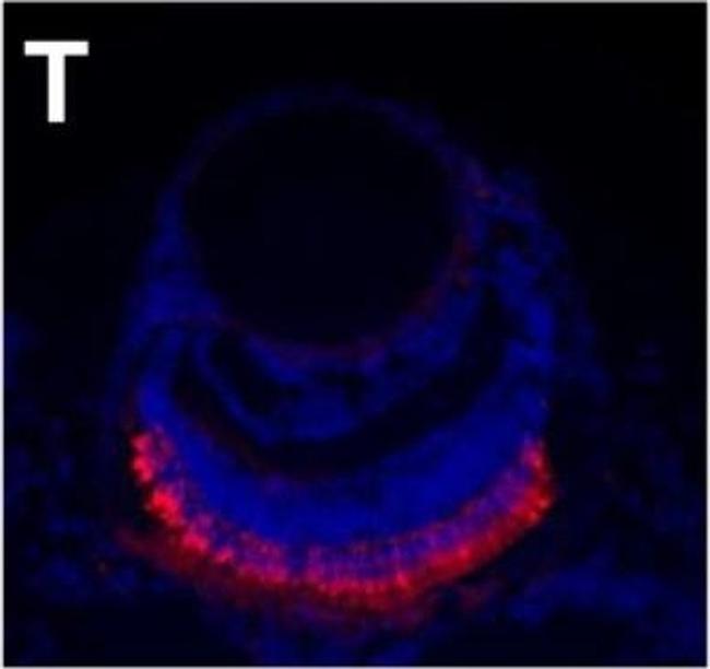 Mouse IgG2a Cross-Adsorbed Secondary Antibody in Immunohistochemistry (IHC)