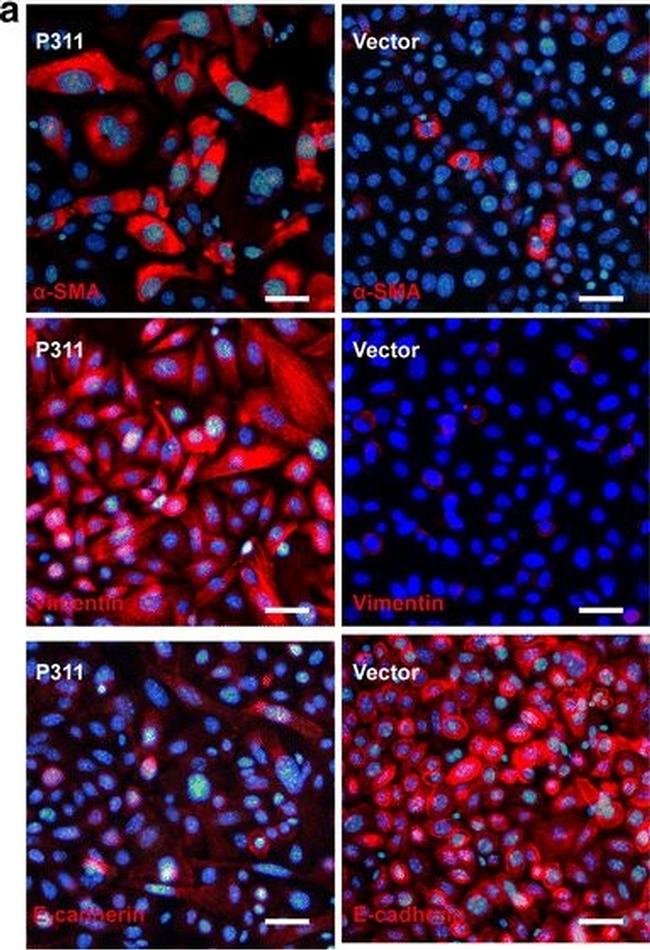 Rabbit IgG (H+L) Highly Cross-Adsorbed Secondary Antibody in Immunocytochemistry (ICC/IF)