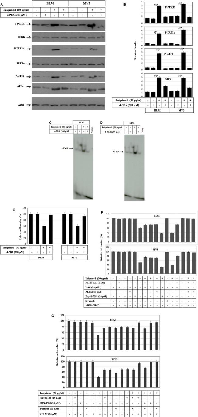 Phospho-IRE1 alpha (Ser724) Antibody in Western Blot (WB)