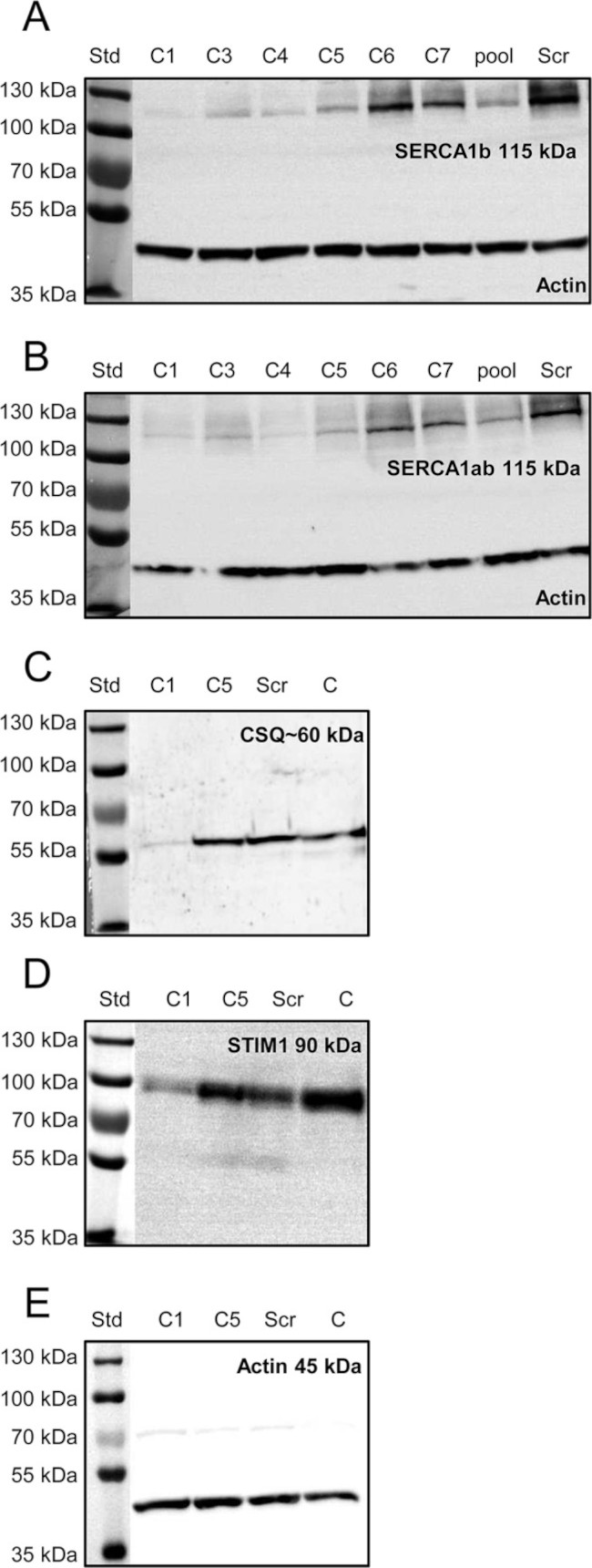 SERCA1 ATPase Antibody