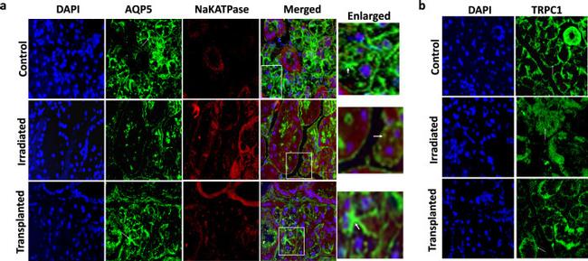 Aquaporin 5 Antibody in Immunohistochemistry (IHC)