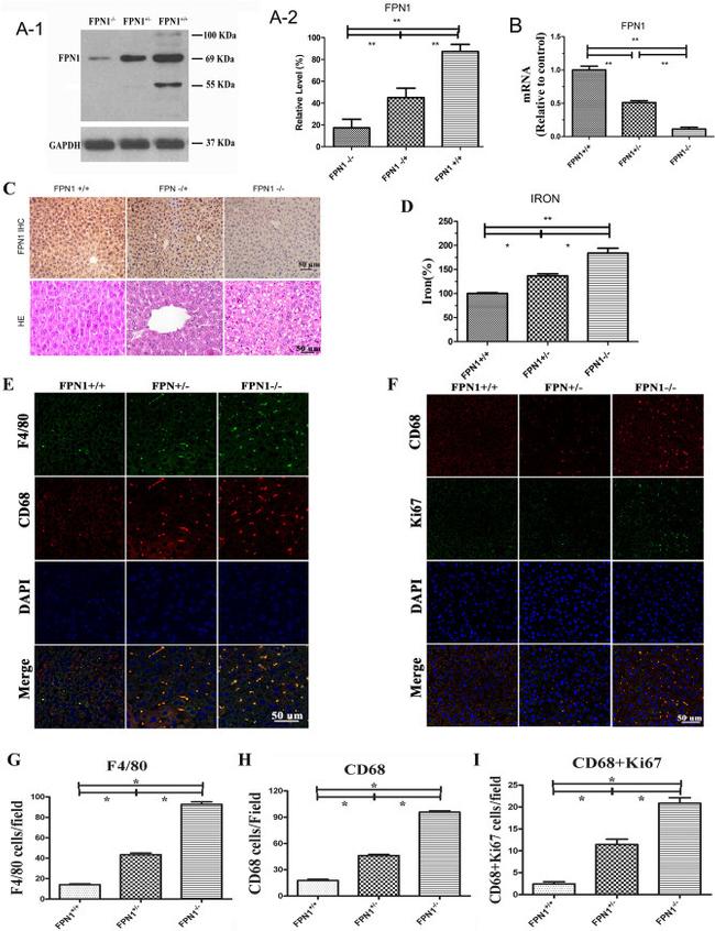 CD68 Antibody in Immunohistochemistry (Paraffin) (IHC (P))